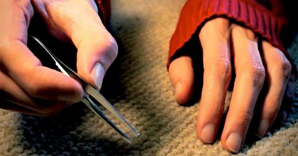 Carpet Hair Transplant